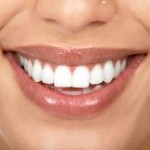 white-teeth-gray-hair2-150x150